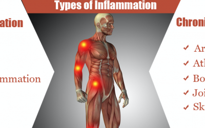 Food that cause inflammation